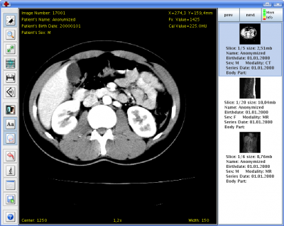 Visionneuse DICOM